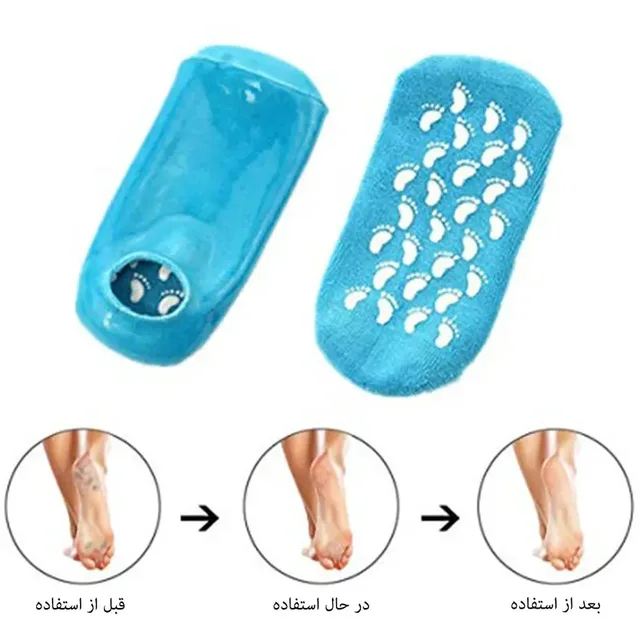 جوراب سیلیکونی ترک پا، تصویر شماره 3